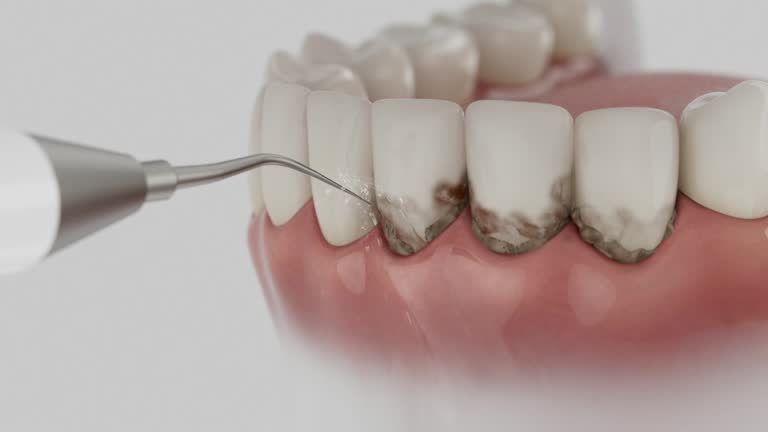 Trusted Invisalign Clear Aligners service in Albion, IN - Dentist Open Now
